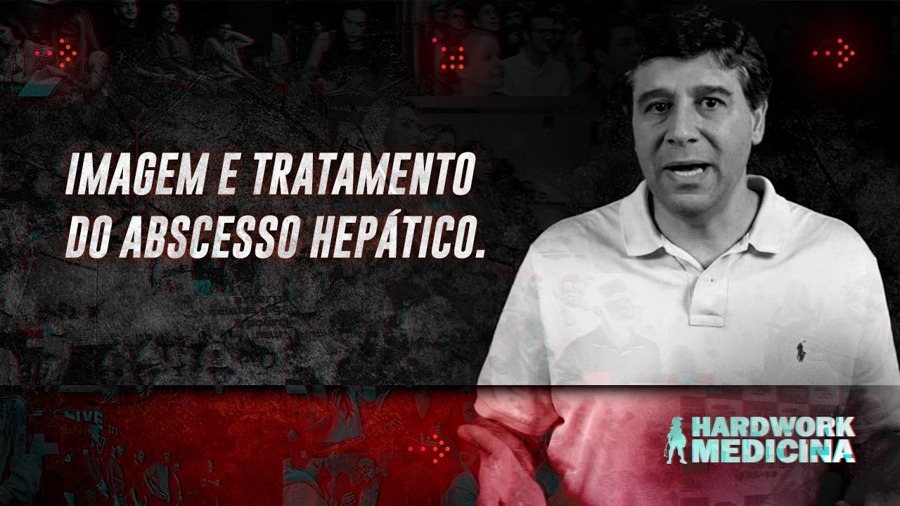 IMAGEM E TRATAMENTO DO ABSCESSO HEP&Aacute;TICO l HARDWORK MEDICINA