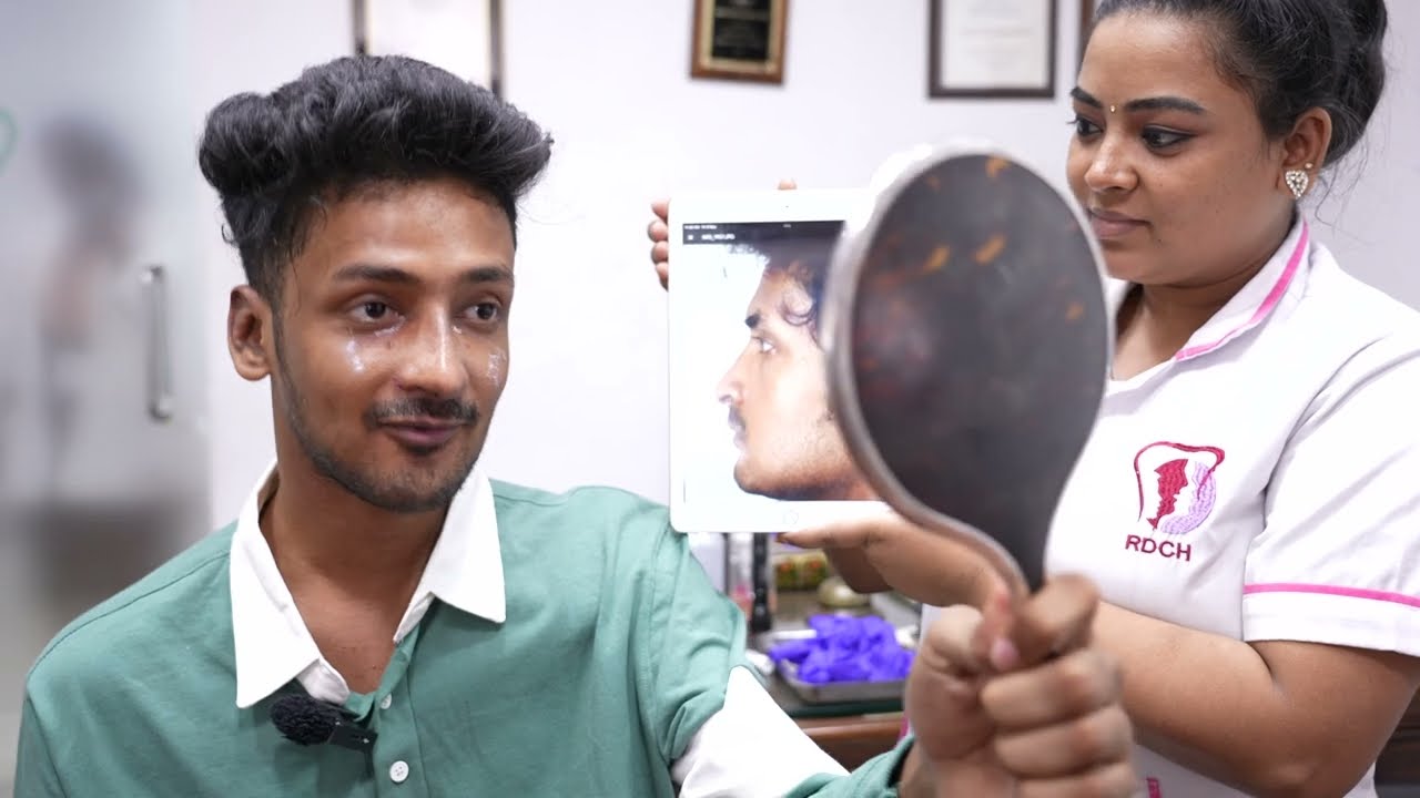 Young man Very Happy After his Rhinoplasty Results - Before & After