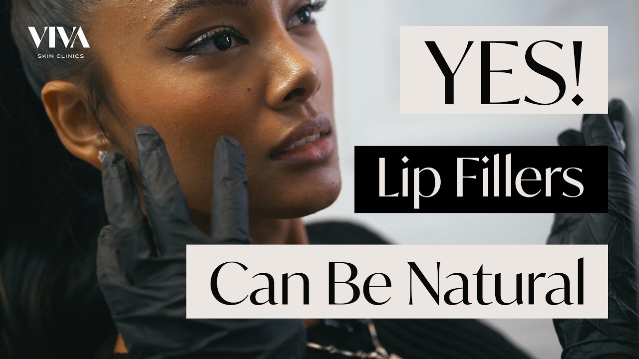 Natural Lip Filler Procedure 👄 Before & After of Subtle and Delicate Lip Modification