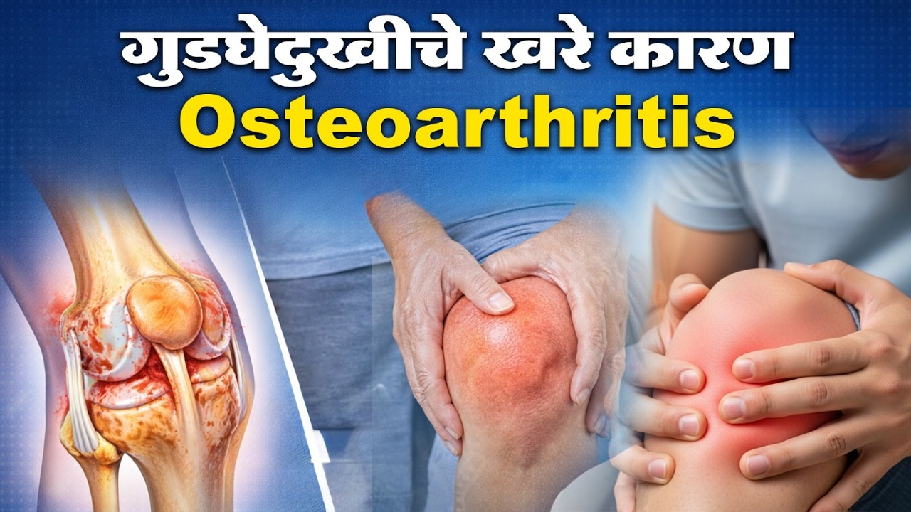 गुडघेदुखी - कारणे आणि उपचार #kneepain #arthritis