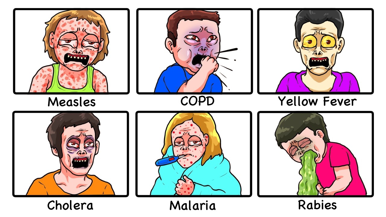 Every DEADLIEST Disease Explained in 14 Minutes