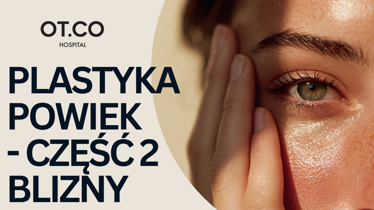 Plastyka Powiek CZ.2 - Blizny po zabiegu czy są widoczne? Jak szybko się goją?