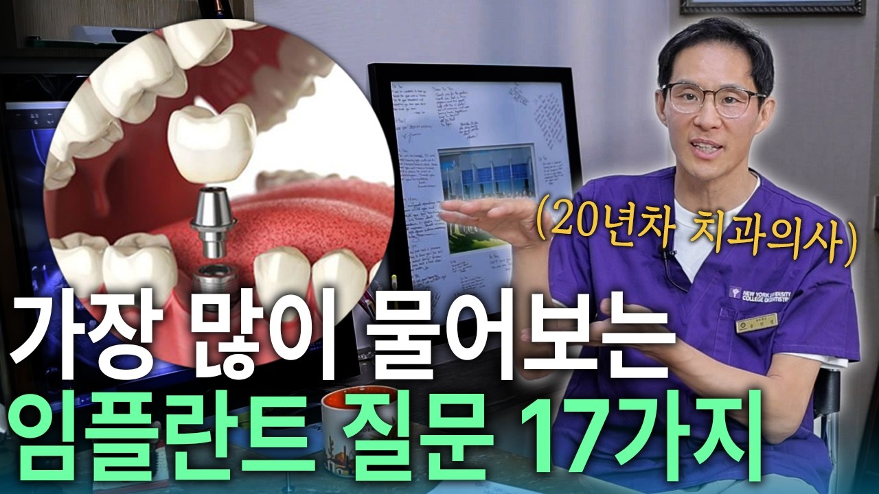 Implant임플란트 궁금한 점 물어보세요!