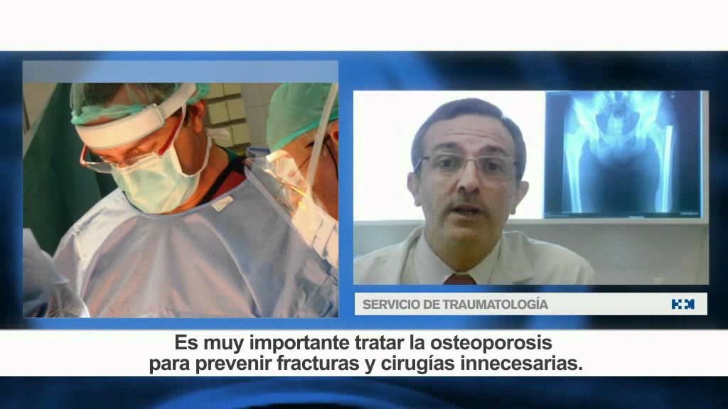 Servicio de Traumatolog&iacute;a de HM Universitario Madrid