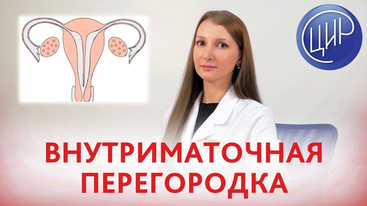 ПЕРЕГОРОДКА В МАТКЕ. Чем грозит наличие внутриматочной перегородки и что с ней делать.