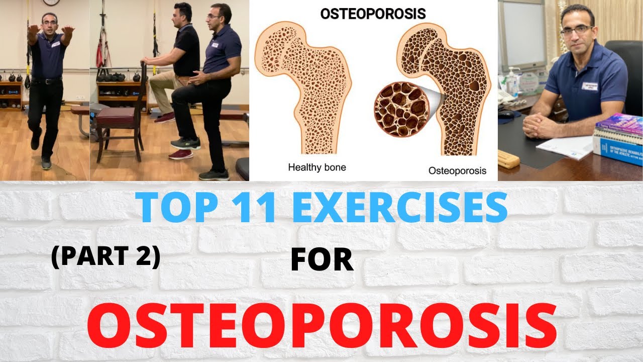 Best Exercises For Osteoporosis | Diagnosis, Treatment & Exercises For Osteoporosis | In Urdu/Hindi