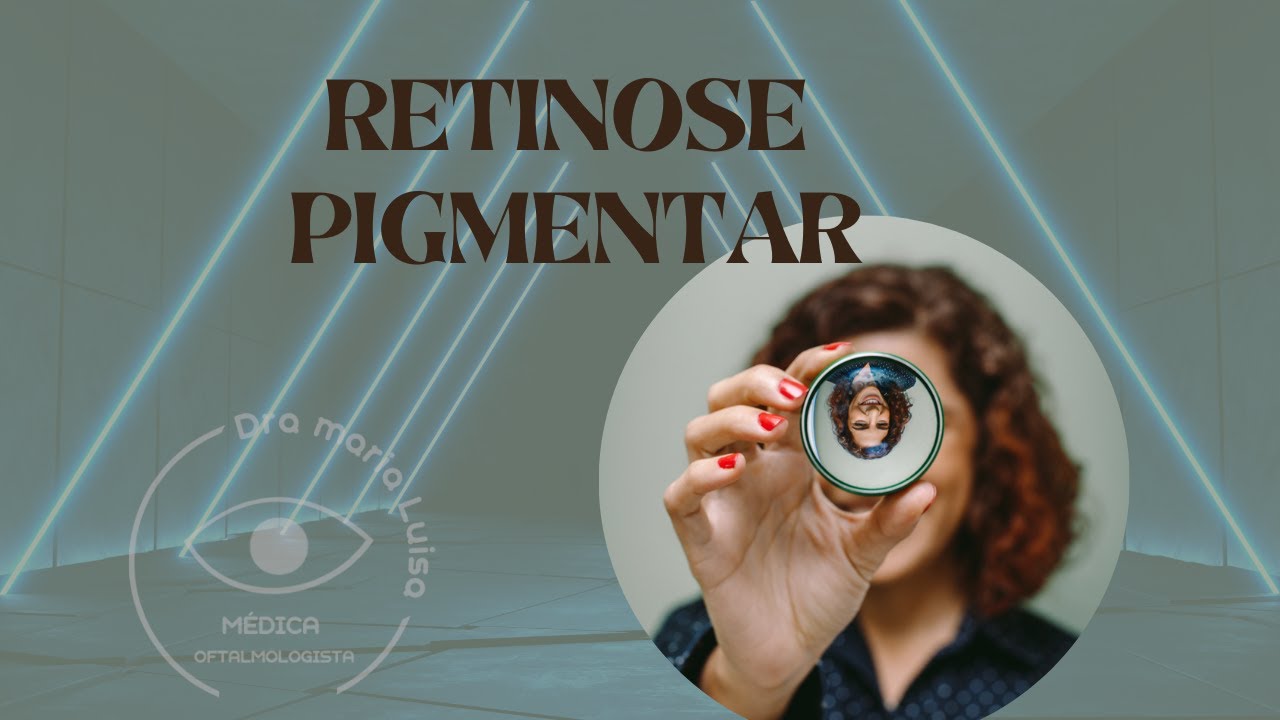 RETINOSE PIGMENTAR - Informações e novidades.