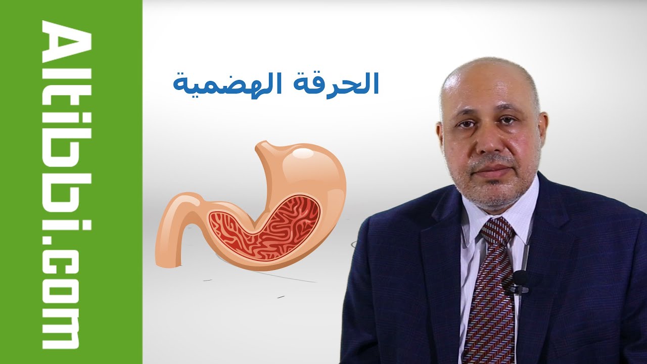 ما هو علاج القرحة الهضمية ؟