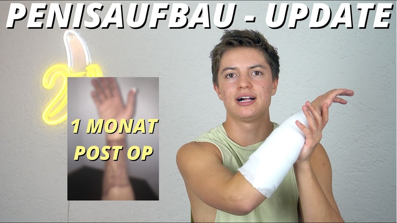ICH HABE EINEN PENIS - Phalloplastik Update 1 Monat post Op - ftm transgender