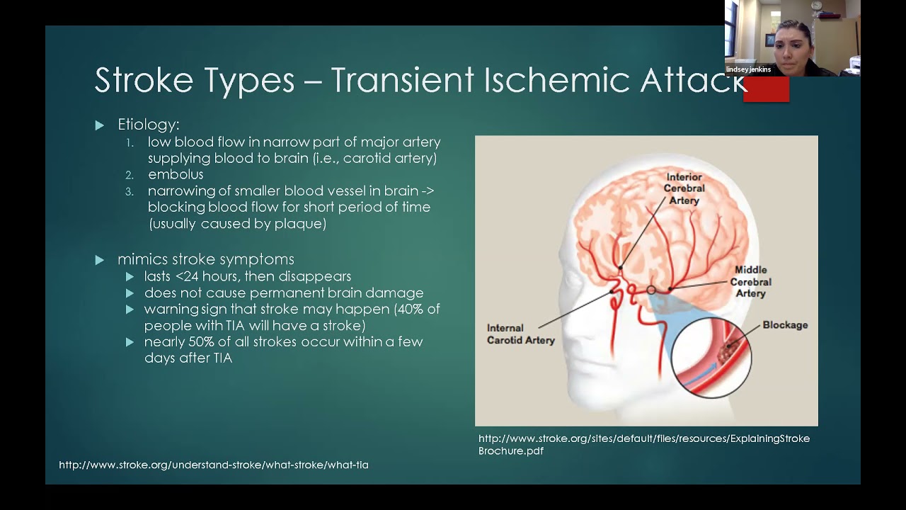 Post-Stroke Depression (Recorded Webinar)