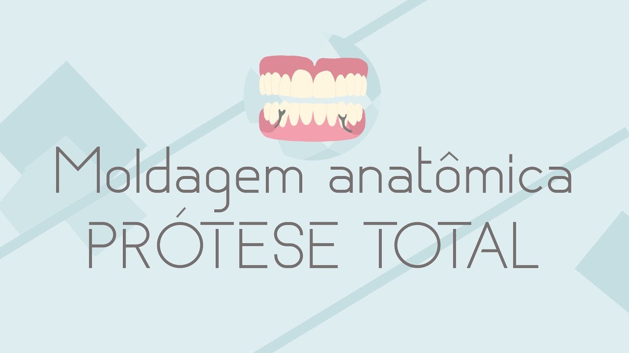 SEQU&Ecirc;NCIA CL&Iacute;NICA Moldagem anat&ocirc;mica de PT com alginato