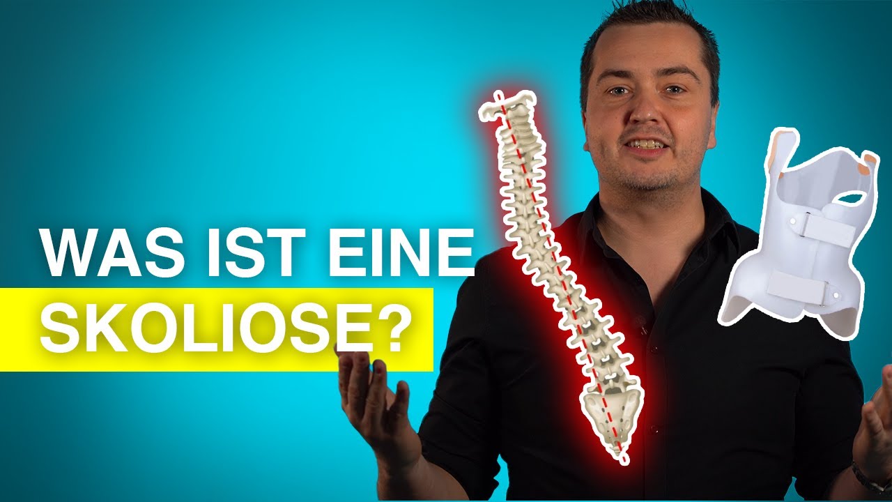 Skoliose: Kurz & verständlich erklärt!
