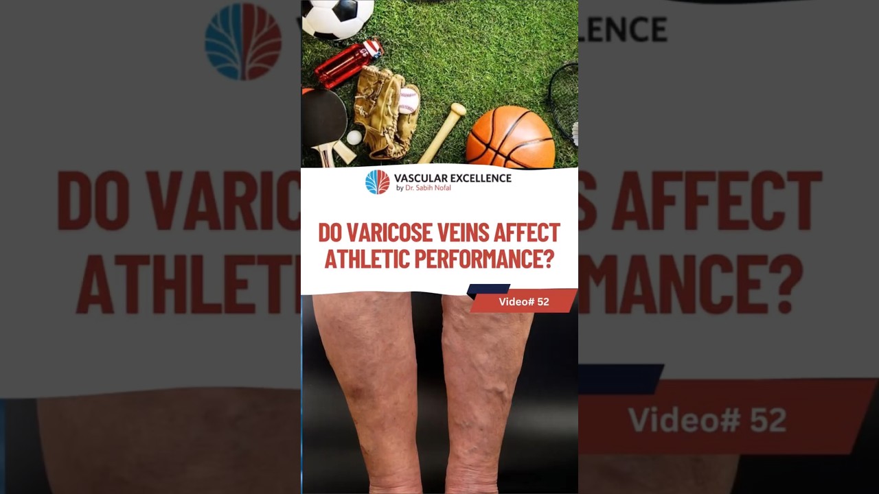 𝐘𝐞𝐬! Varicose veins can lead to heaviness  #drsabihnofal #veinhealth