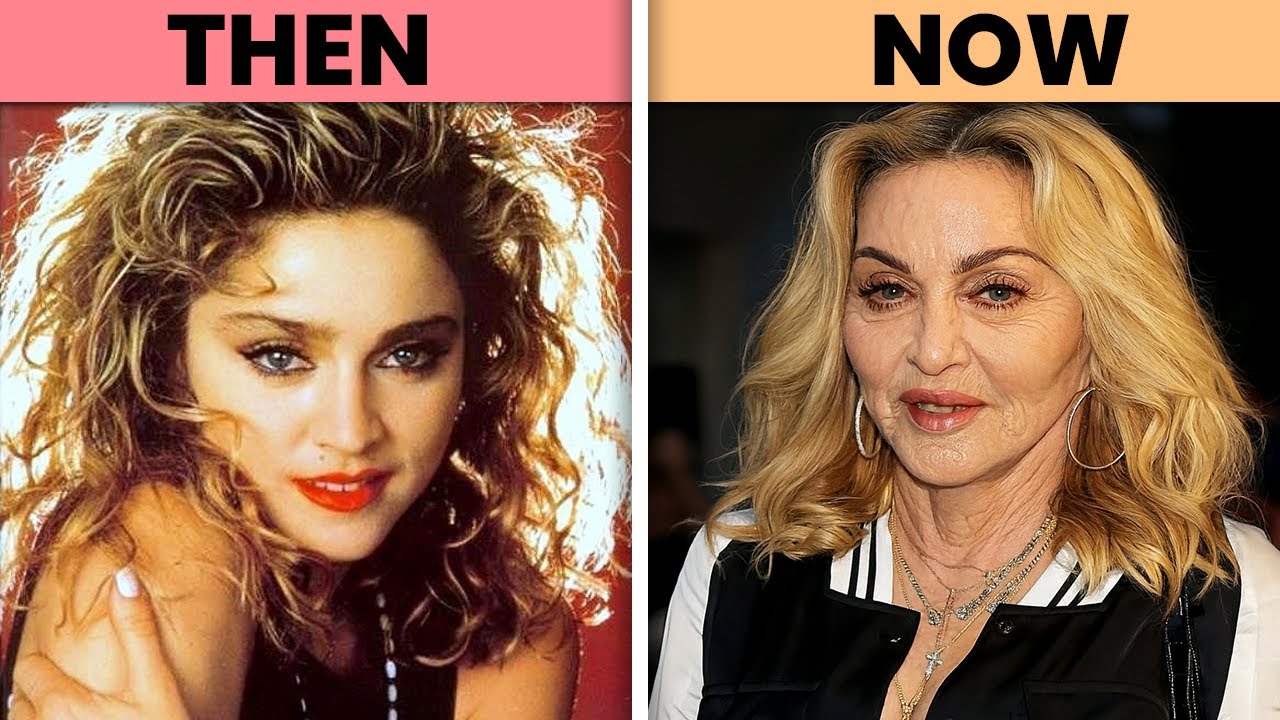 100+ POP STARS of 80s BOTCHED🔥 Then and Now 🎤