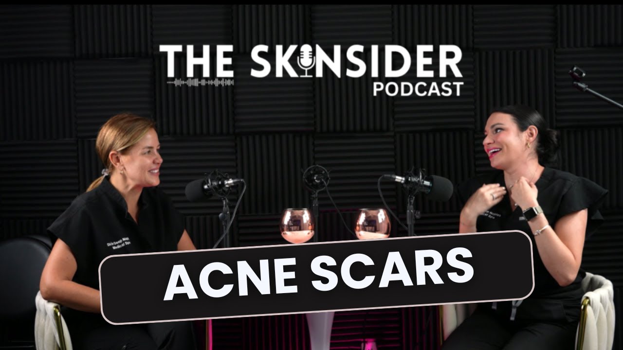 How Medical Threads Help Heal Acne Scars | The Skinsider Podcast Ep.9