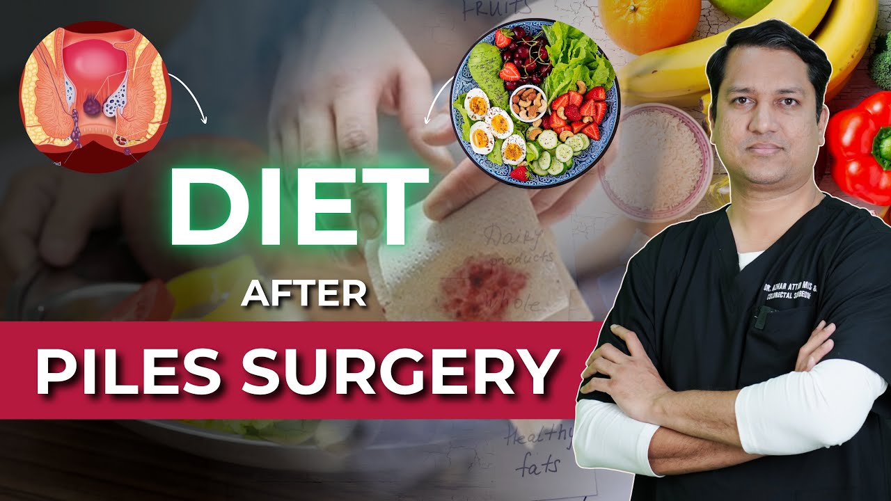 Piles Operation के बाद क्या खाएँ? | Post Piles Surgery Diet & Recovery Tips by Dr Azhar Attar