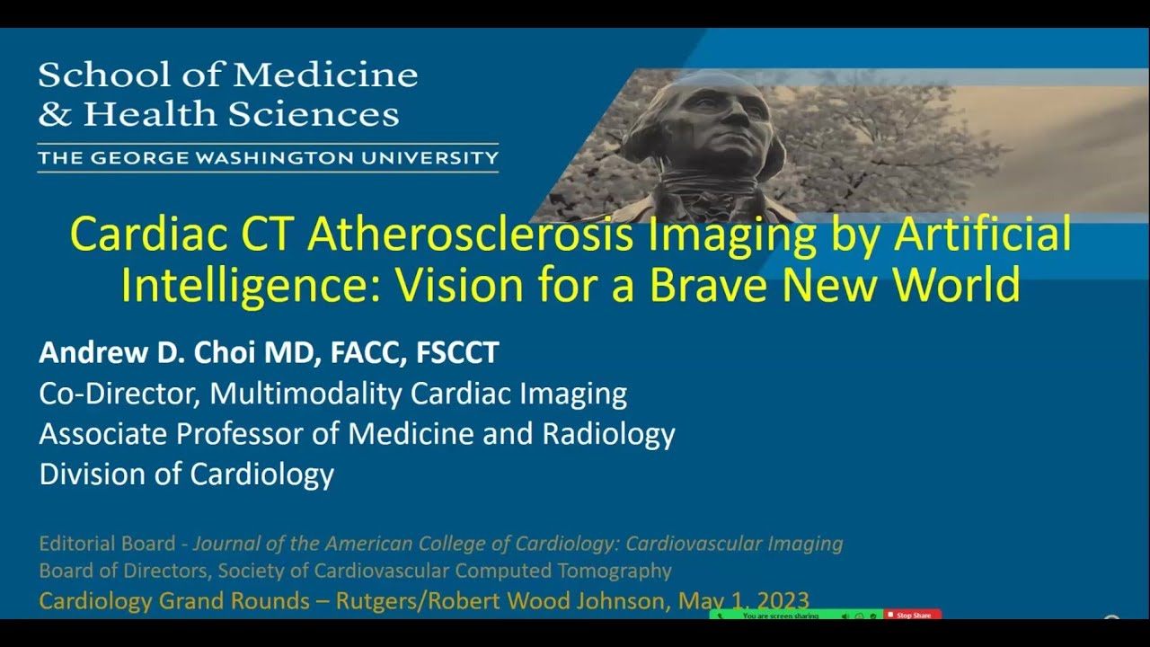 Cardiac CT Atherosclerosis Imaging by AI: Vision for a Brave New World.