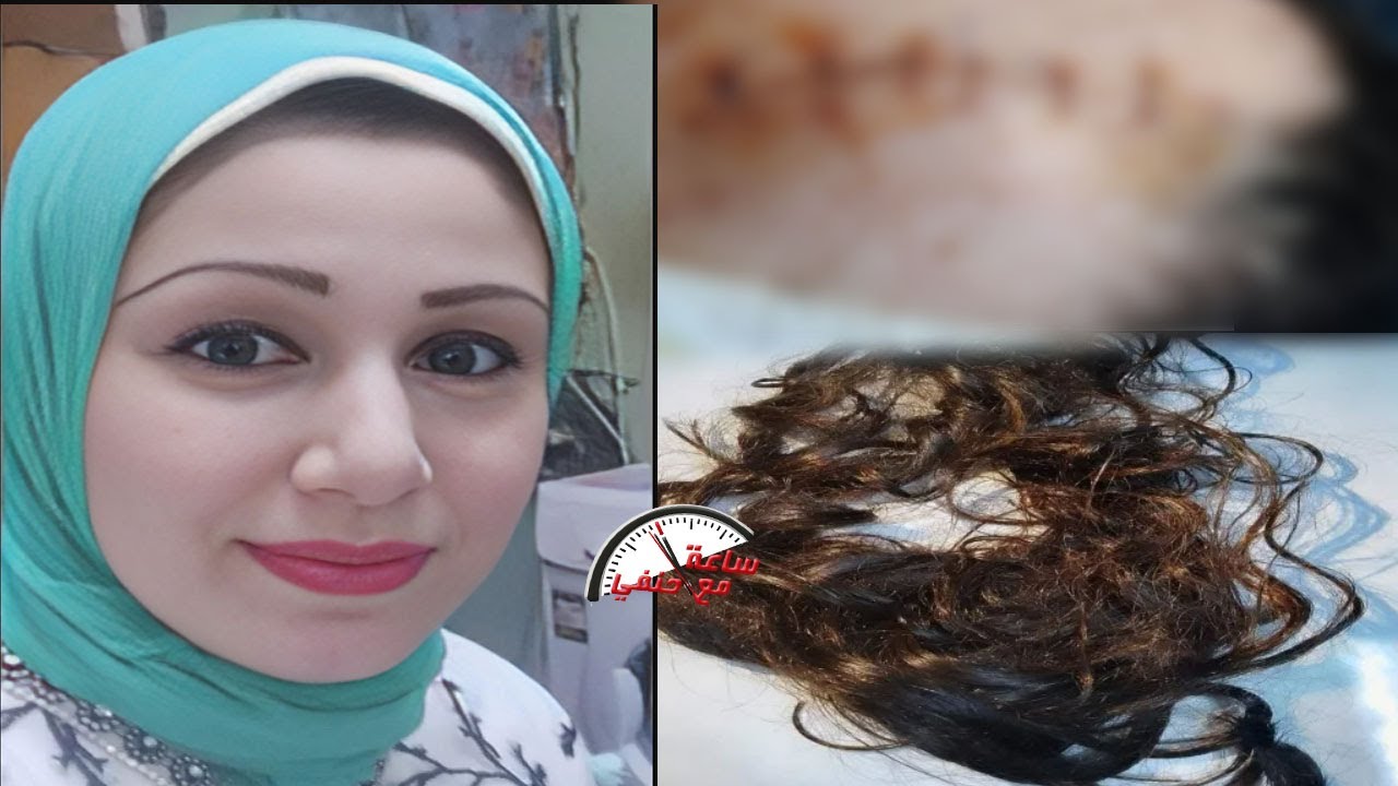أسرة مريض نفسي تتفنن فى تـ ـعـ ـذيــ ـب زوجة أخيم قـ ـصـ ـوا شـ ـعـ ـرها  وفتحولها وشها بـ14 غرزه !!