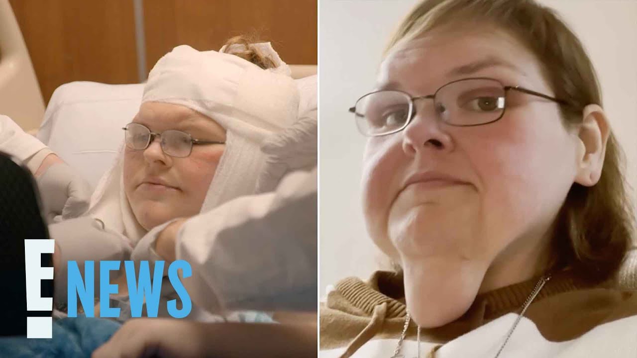 Тэмми Слейтон раскрывает результаты операции по удалению кожи | E! News