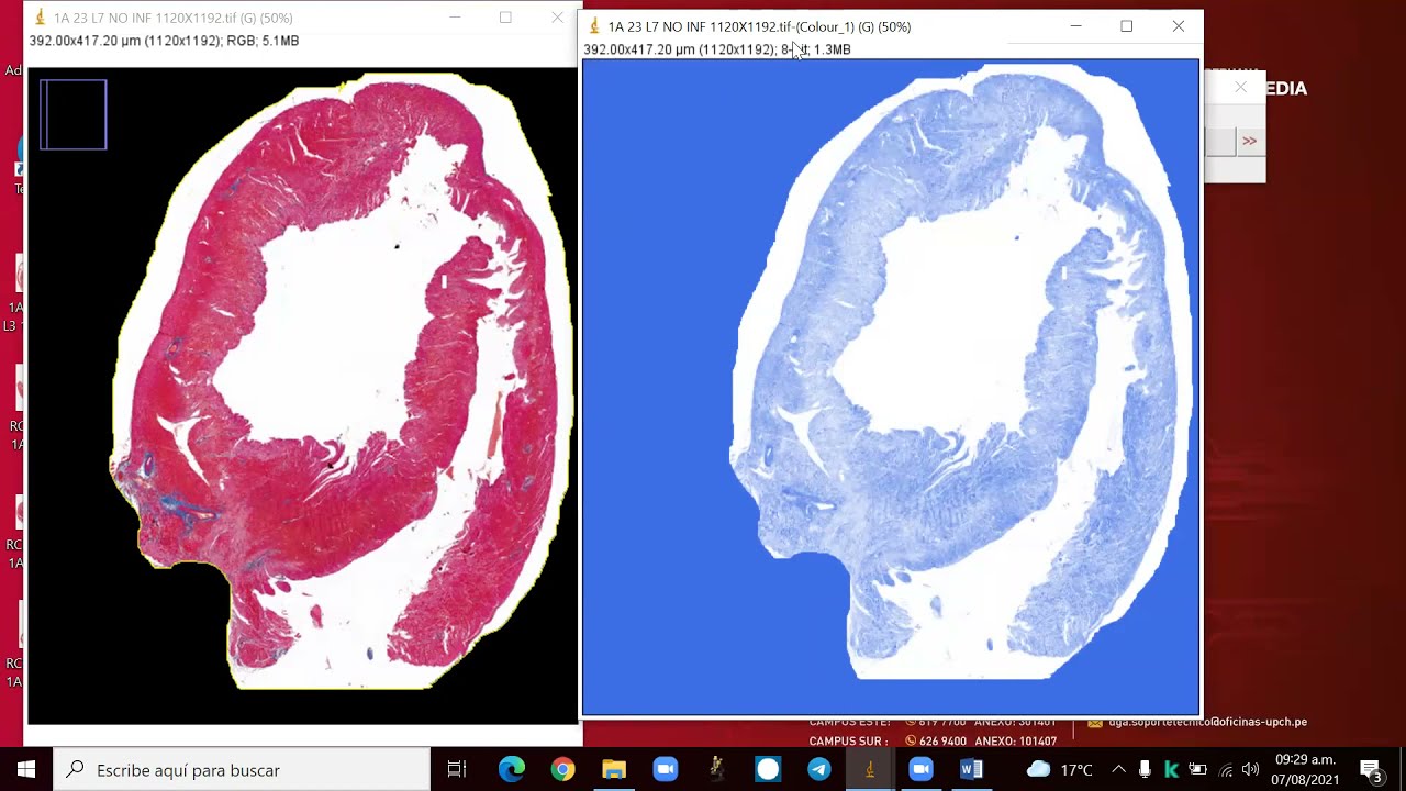ImageJ Analisis de colágeno en muestras de corazón-Tricromica Masson-2