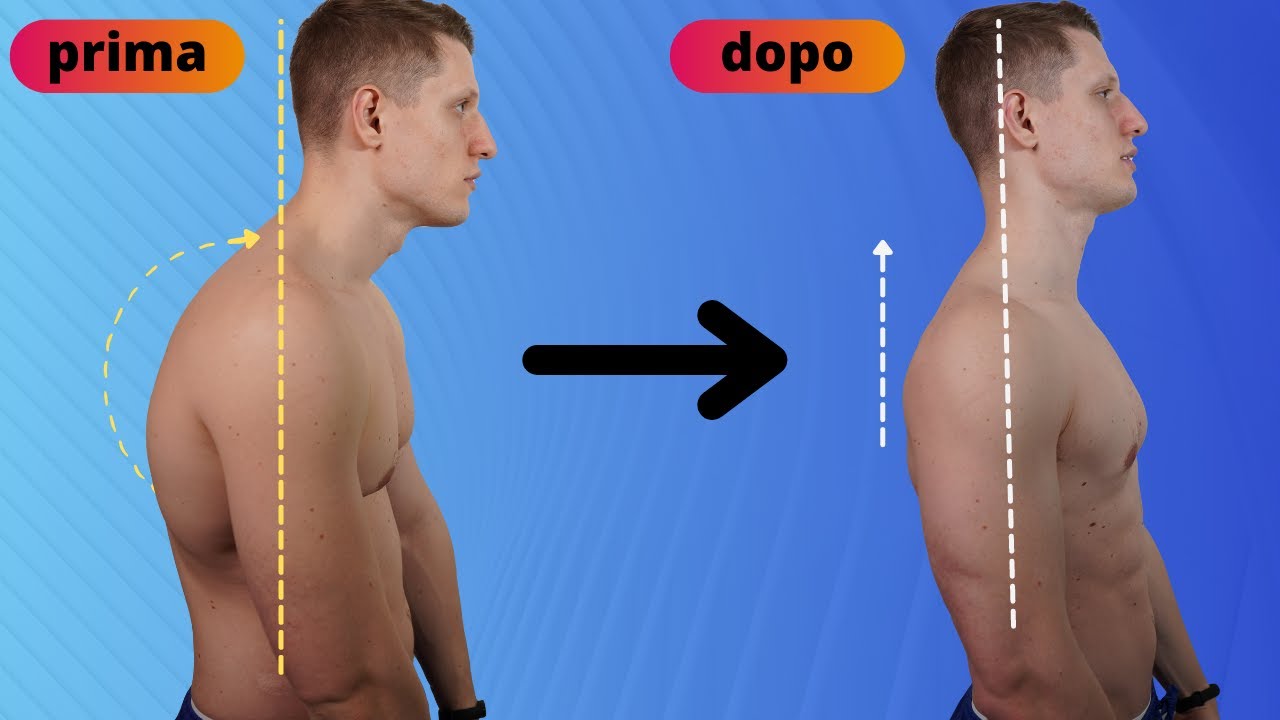 Come correggere la POSTURA delle SPALLE IN AVANTI (in 6 minuti)