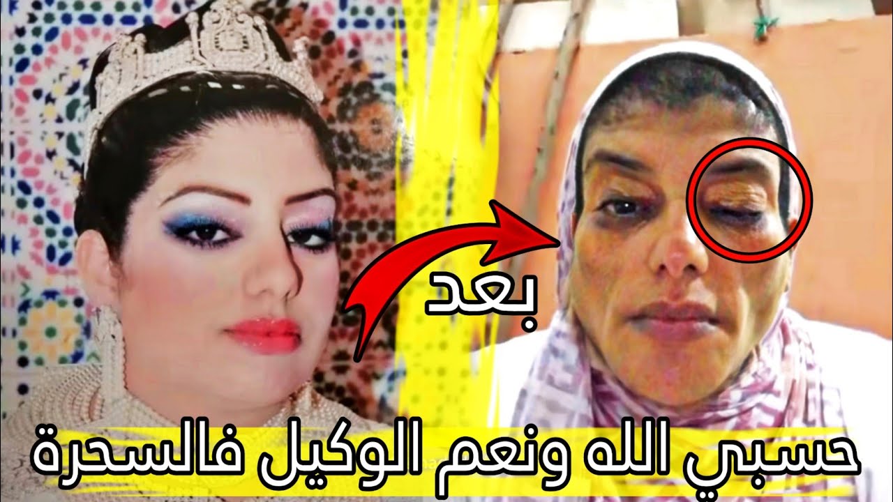نبيلة القوية تدمرات حياتها النفسية والجسدية بسبب السحر نبيلة صاحبة الضحكة الجميلة تطلب منكم الدعاء