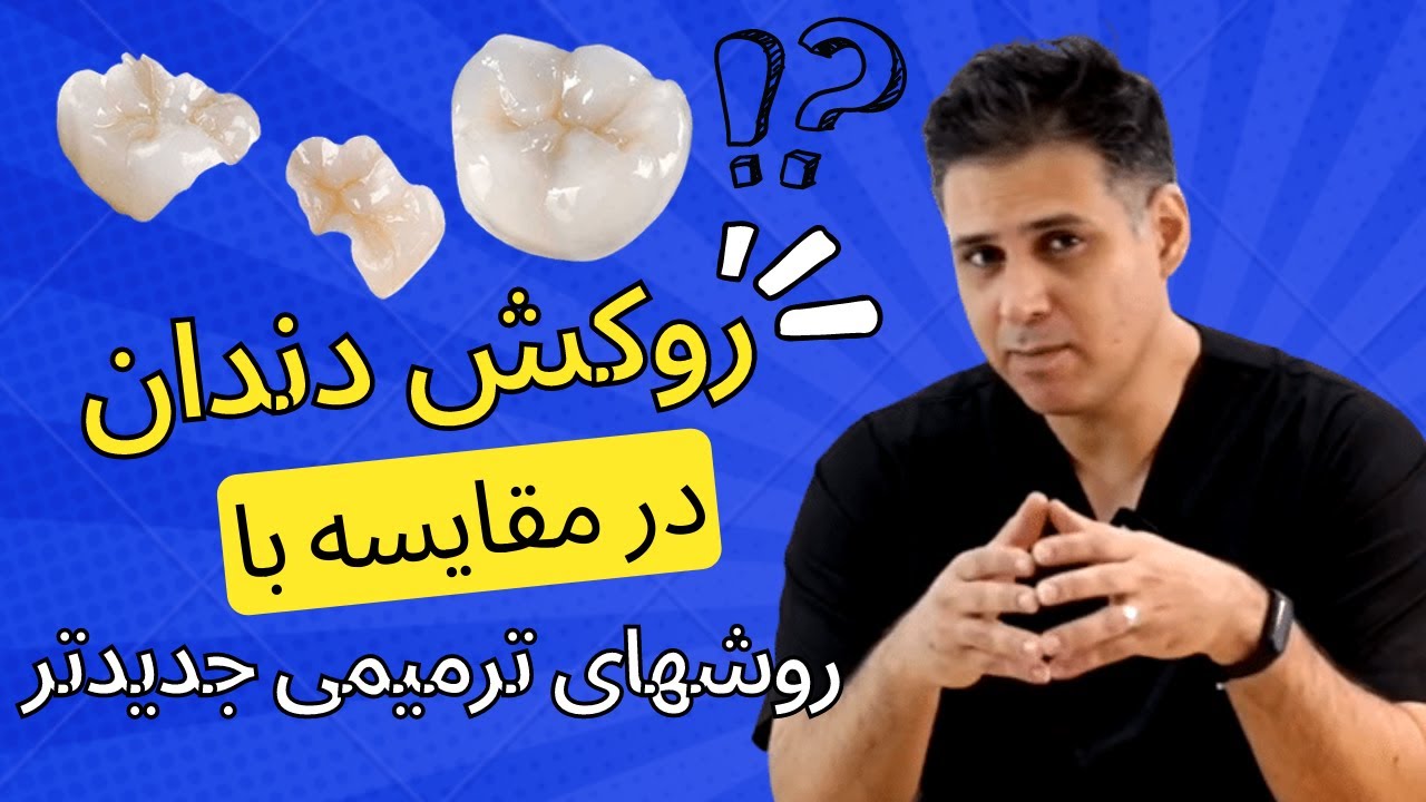 مقایسه روشهای مختلف ترمیم تاج دندان بعد از عصب کشی کردن | بهترین روش ترمیم دندان کدومه؟