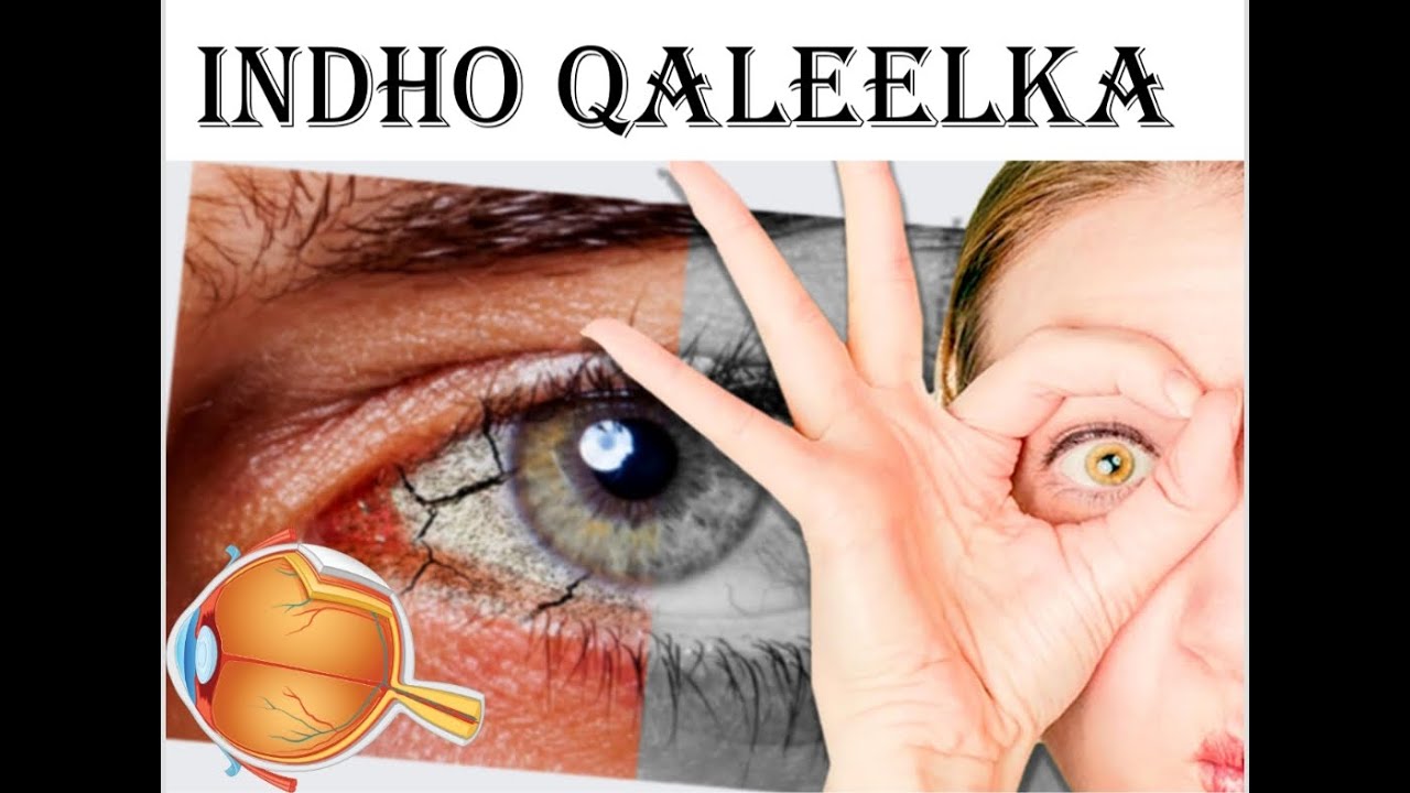 INDHO QALEELKA IYO SIDA LOOGA HORTAGO Dr Fahad Al Attas.