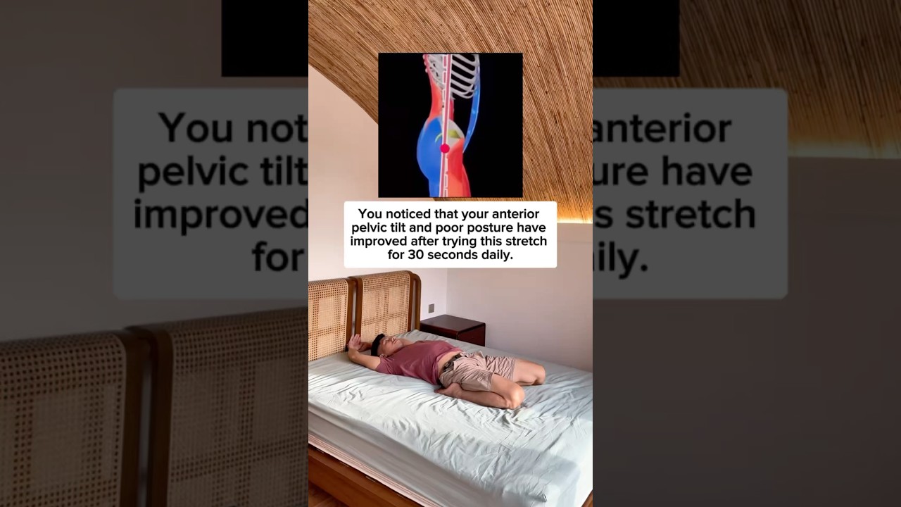 Fix Your Anterior Pelvic Tilt Posture!!