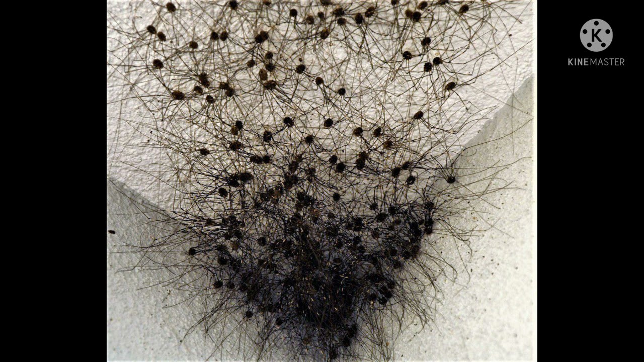 Do you know about  the HARVESTMAN’S LEGS