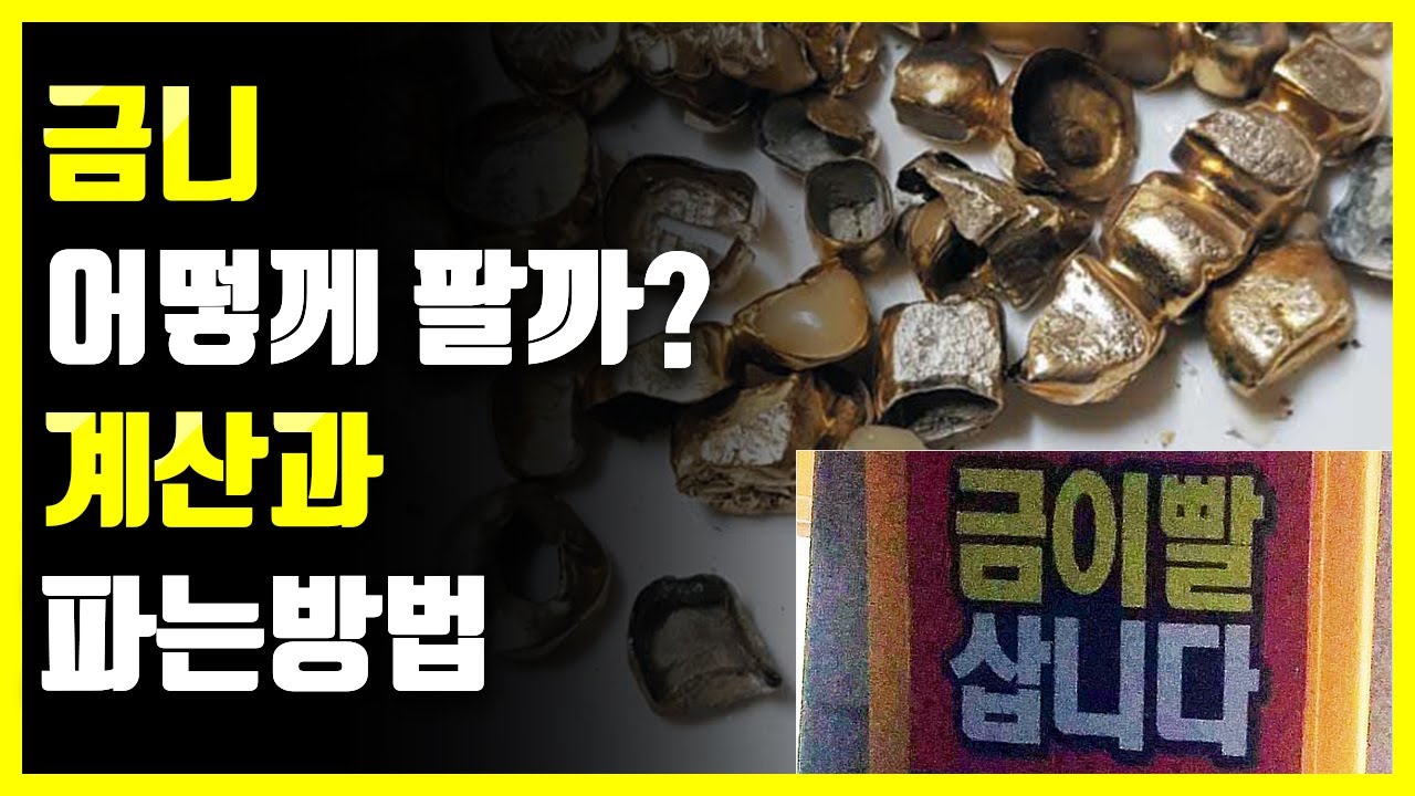 금니는어떻게 팔아야할까?