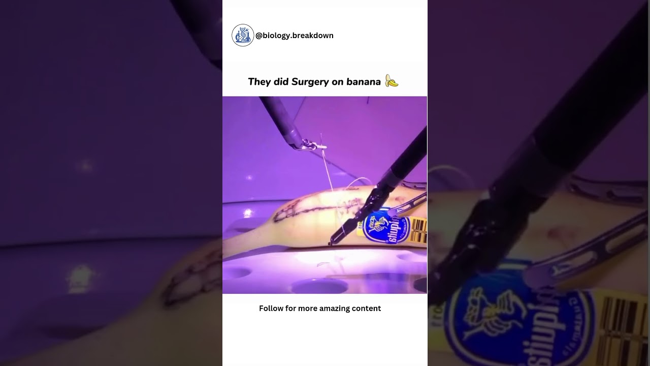 They Performed Surgery on a Banana? 🍌🩺  #biologybreakdown #surgeryday #banana