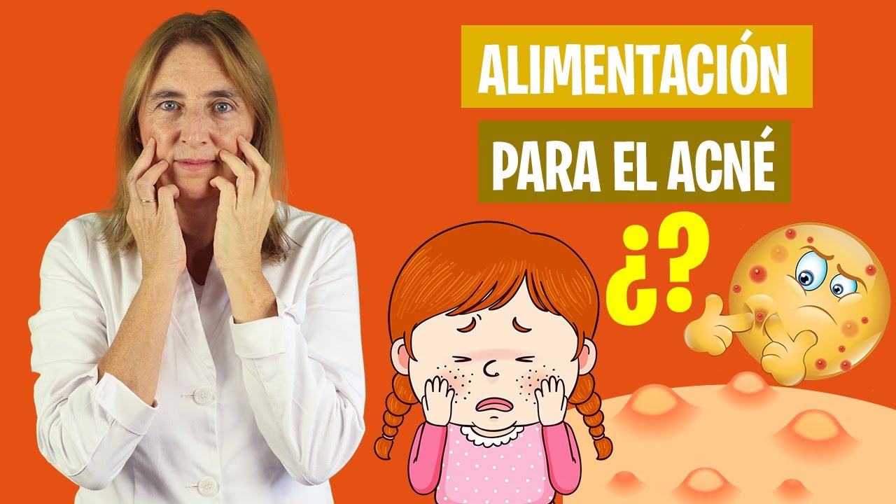La MEJOR ALIMENTACIÓN para ACNÉ en ADOLESCENTES | Qué alimentos afectan al acné | Nutrición infantil