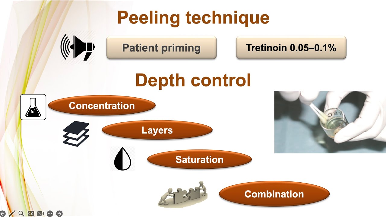 Chemical peeling part 2