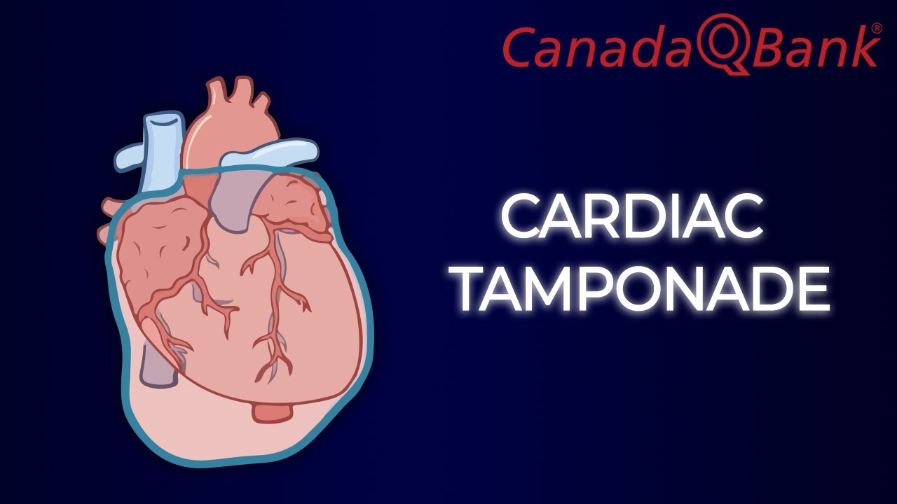 Cardiac Tamponade
