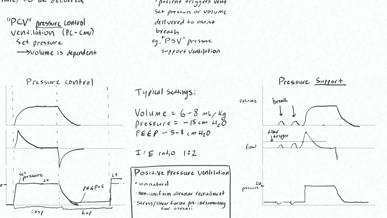 Ventilator Modes 1 - Volume and Pressure Control, Pressure Support