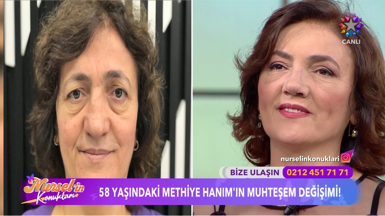 Dr. Nihat Dik | Methiye Hanım'ın Değişim Hikayesi | STAR TV