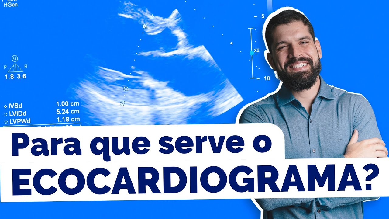 ECOCARDIOGRAMA - O ultrassom do coração. [EXAME EXPLICADO]