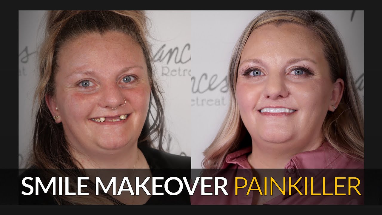 How this Missing Teeth story changed a woman's life - Brighter Image Lab.com