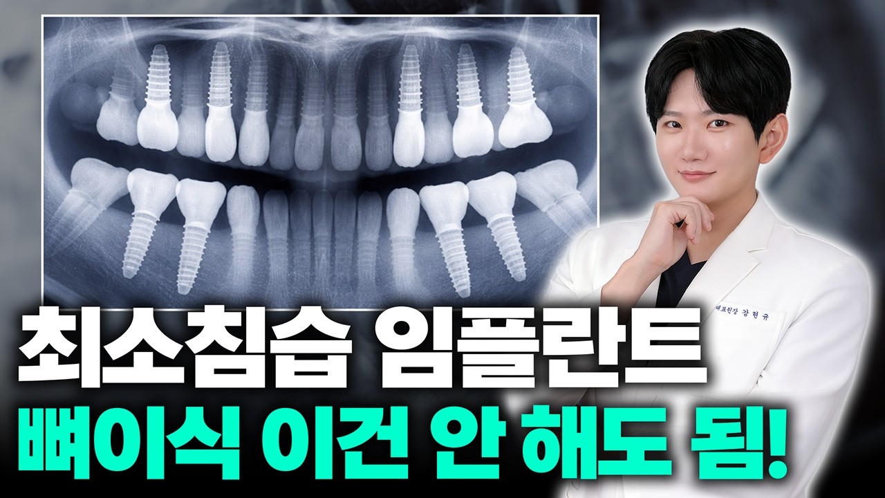 임플란트 뼈이식, 무조건 해야 할까요? (안 해도 되는 경우 알려드립니다)