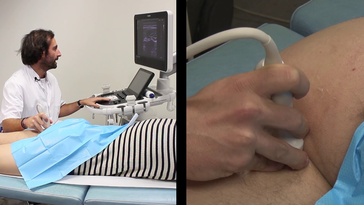 Groin pain and ultrasound - part 7 - Posterior aspect of the hip and hamstrings tendons