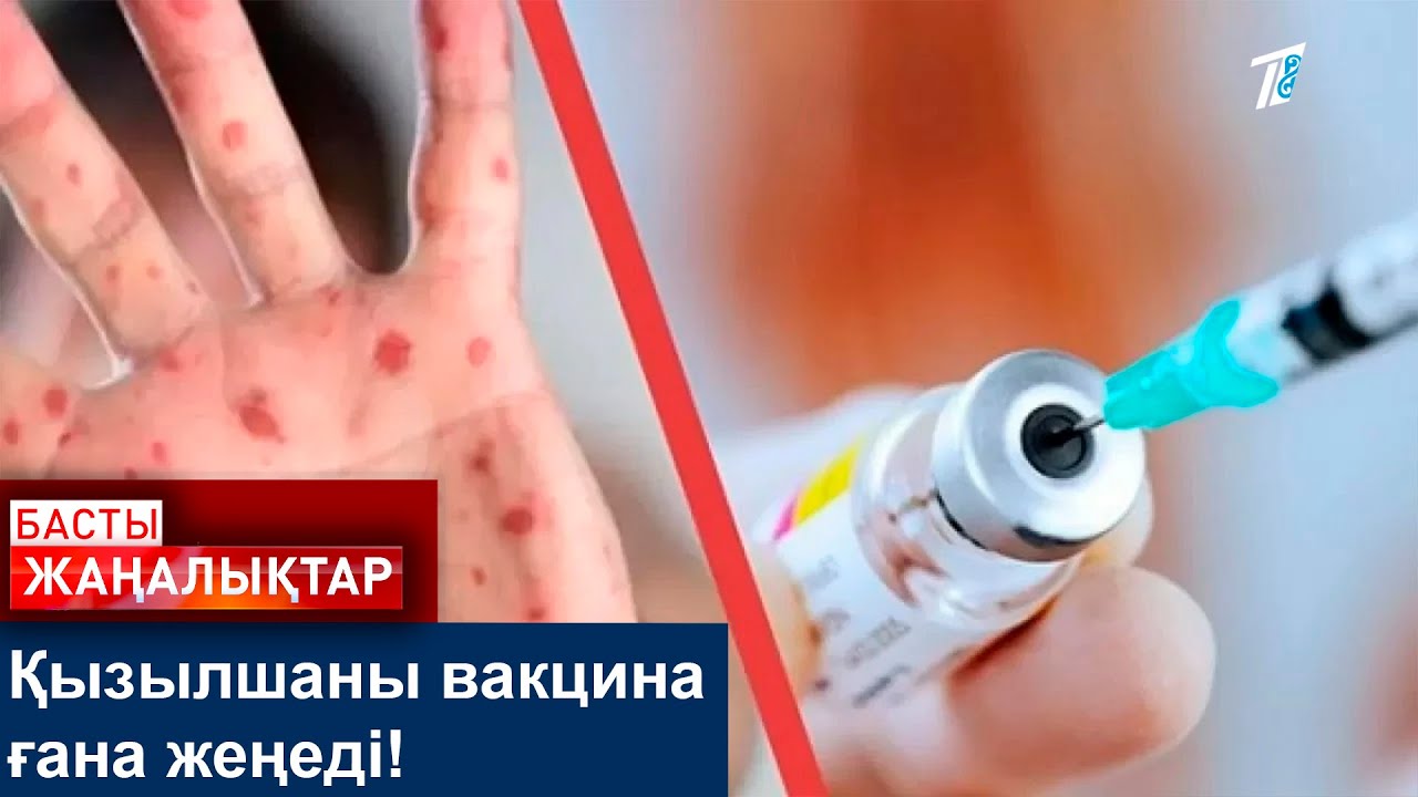 Қызылшаны вакцина ғана жеңеді!
