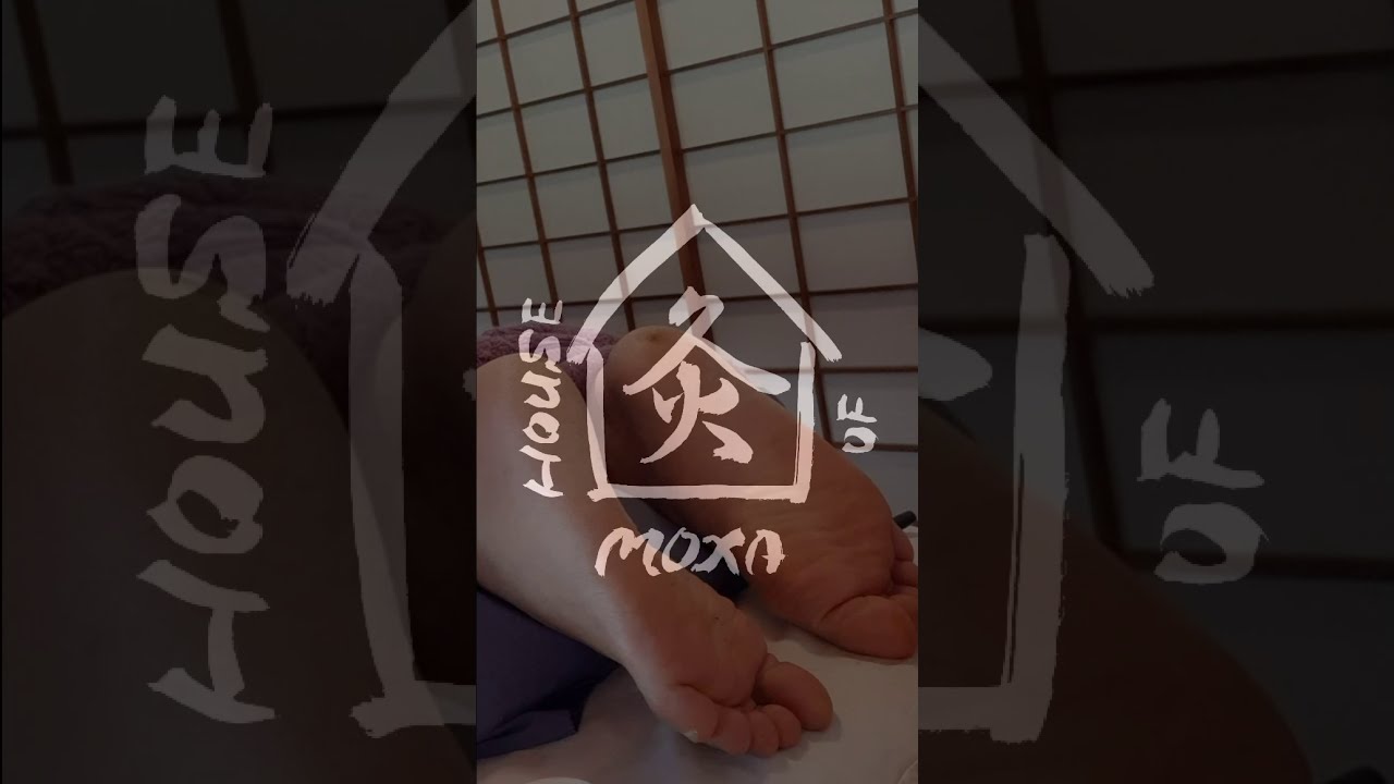 Rice Grain Moxa or Direct Moxa (Tonetsukyu) - rolling by hand