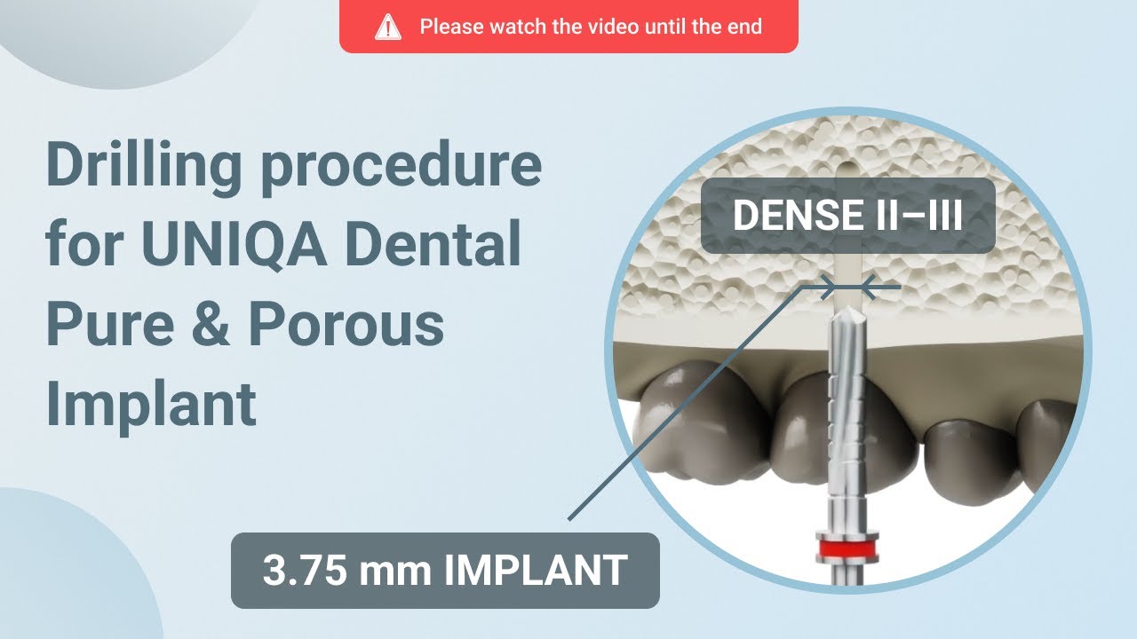 Drilling procedure for UNIQA Dental Pure & Porous Implant UH8 UV11 [ 3.75 mm | D2-D3 bone density ]