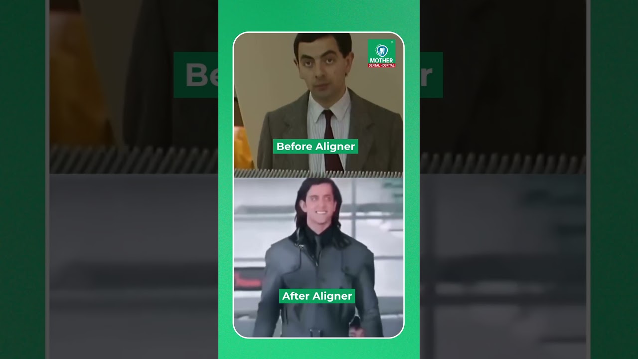 Get Your Dream Smile with Clear Aligners at Mother Dental | Invisible & Effective!