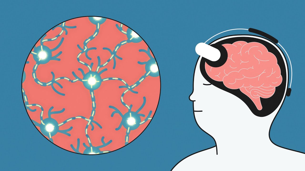 What is tDCS