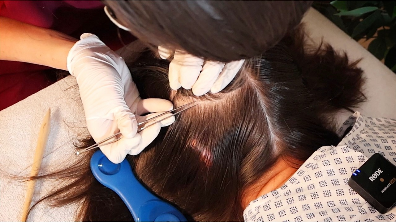 ASMR School Nurse LICE Check on SCALP and NAPE | Removal with a Comb and Tweezers