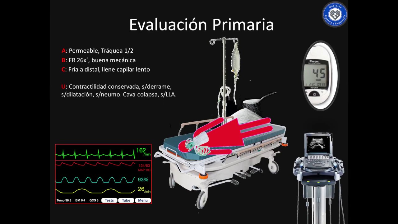 Shock indiferenciado, enfrentamiento del Medico de Urgencia #FOAMed #MUE #ChileEM