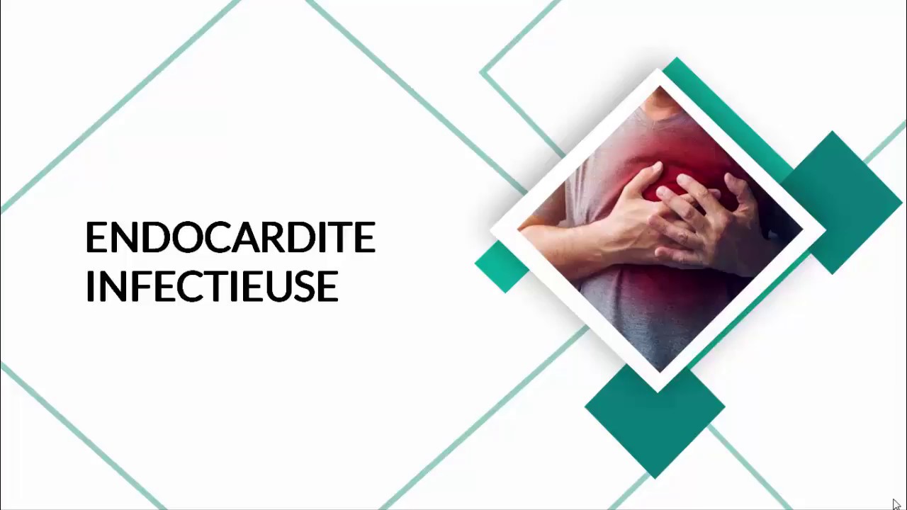 Cardiopathe et soins dentaire | Endocardite infectieuse | prise en charge #dentist #cardiology