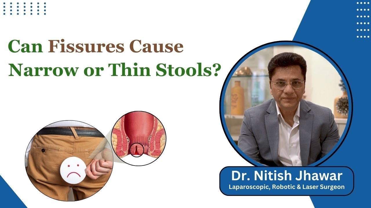 Can Fissures Cause Narrow or Thin Stools? || Dr.Nitish Jhawar